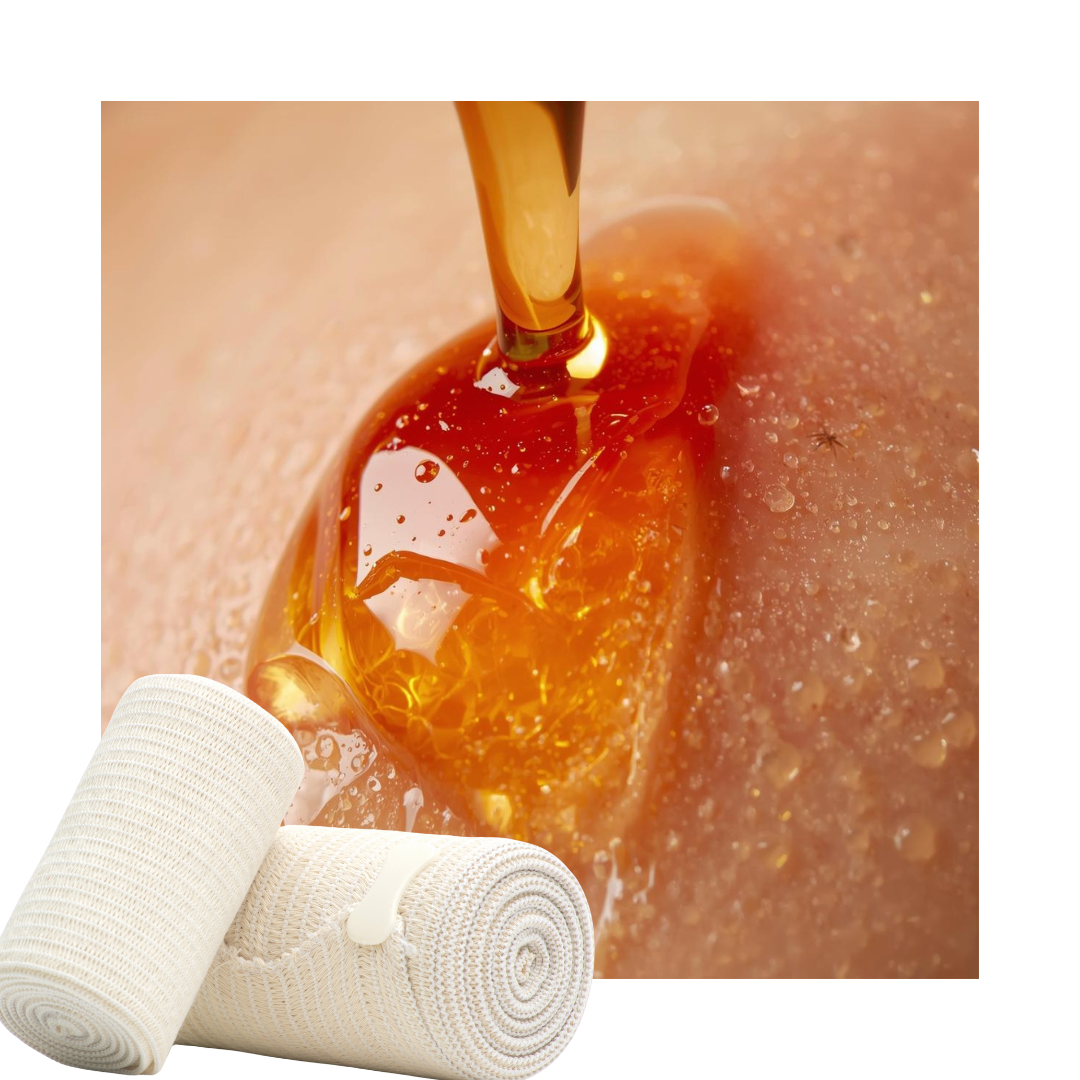 How to dress wounds with Manuka Honey